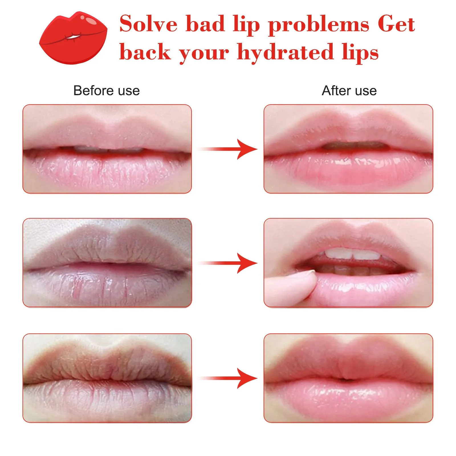 Sefudun Night Sleeping Lip Mask 20Pcs, Collagen Lip Patches, Moisturizing Lip Sleep Mask